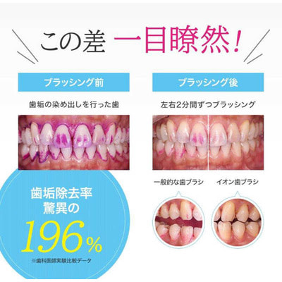 Ionic "Ionpa Beauty"      + 2   +  ,  , , 1 . (,  3)