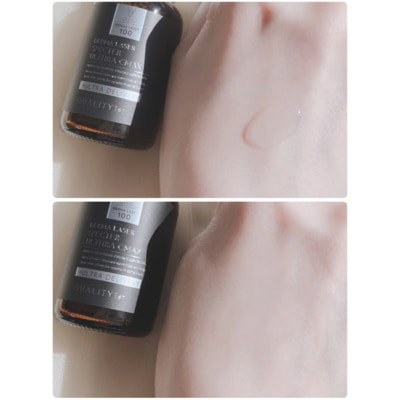 Quality First "Derma Laser Specter Ulthera CMAX" ��������� ��� ���� � ������� ������������� �������� �, ��� ������� ���, 30 ��. (����, ��� 3)