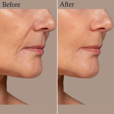 Eunyul "Wrinkle Repair"   ,   , 5   12 . (,  4)